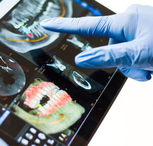 What to Expect with a full mouth reconstruction in Highlands Ranch from HR Family Dental