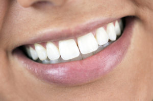 Whiter smile for 2020 at Highlands Ranch Family Dental