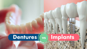 Fix missing teeth in Highlands Ranch at HR Family Dental with Dental Implants