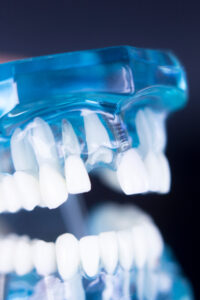 Missing one or more teeth? Dental implants in Highlands Ranch, CO, at HR Family Dental, led by Dr. Lunn, offer a long-lasting, natural-looking solution to restore both function and appearance. Our specialized implant dentistry helps patients eat, speak, and smile with confidence again. Serving Highlands Ranch, Lone Tree, Castle Pines, and the greater Denver Metro Area, Dr. Lunn creates personalized treatment plans using advanced technology and a compassionate approach, ensuring minimal discomfort and exceptional results.