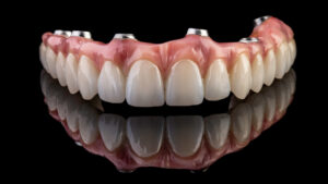 Full Mouth reconstruction treatments