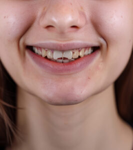 Dental reconstruction in Highlands Ranch, CO